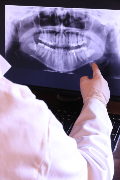 Best Emergency Treatment for Toothache in Runnemede, NJ